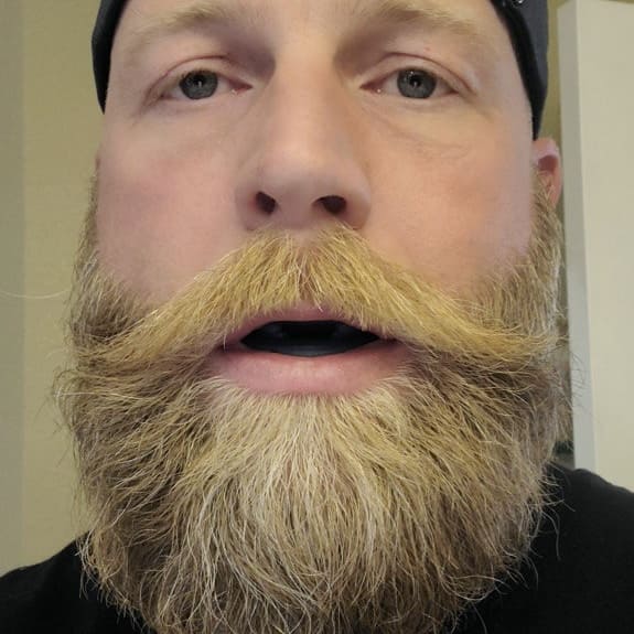 Sanvero™ – Bite antirussamento con misura universale